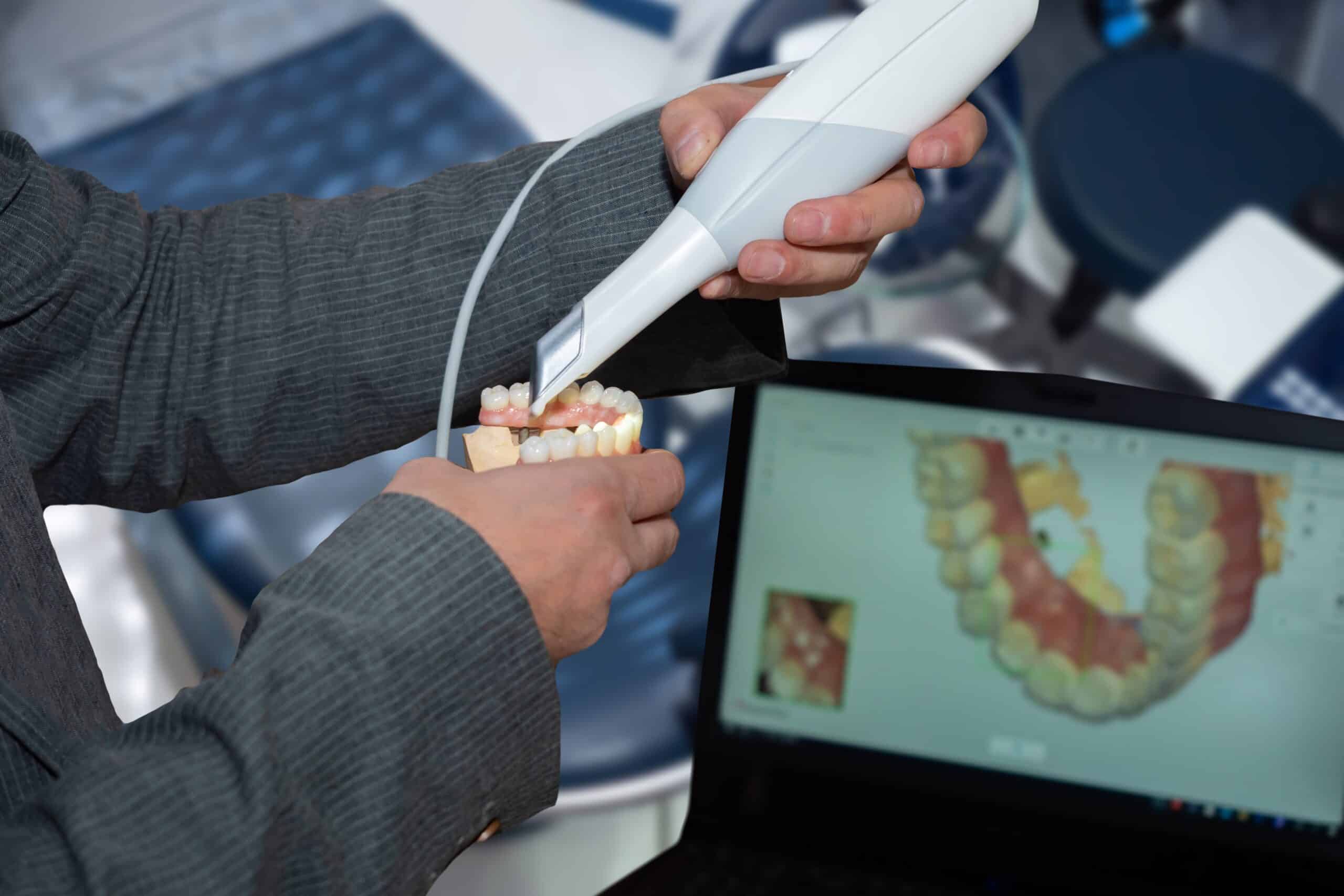 Denture,Scanning,Process.,Checking,Teeth,With,An,Intraoral,Scanner.,Dental